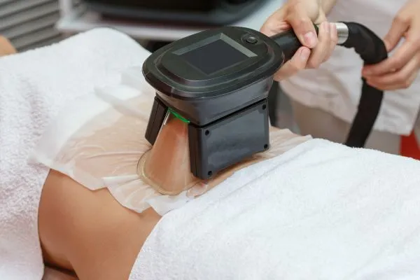 Image of person having fat freezing treatment to help weight gain Little Bognor